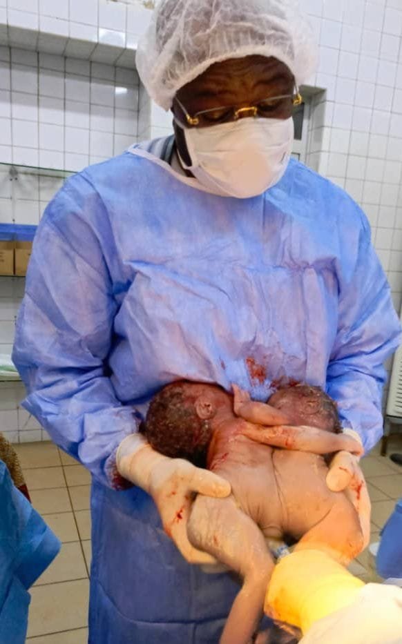 Maternité : le Pr Charlemagne réalise une césarienne de bébés siamois 2