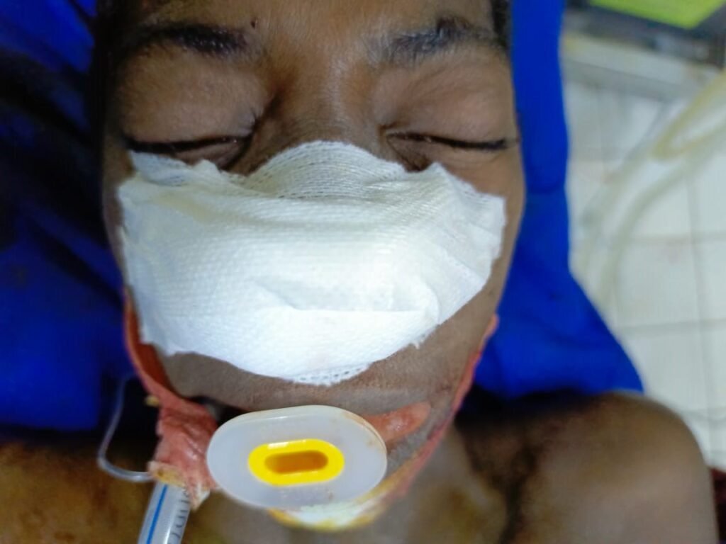 CHU Yalgado : Une masse tumorale retirée avec succès chez une patiente de 37 ans 3